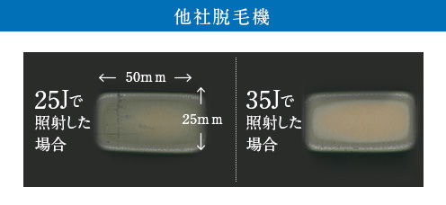 他社脱毛機